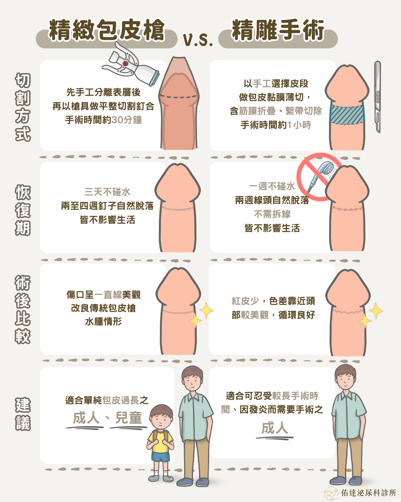 包皮槍手術選擇