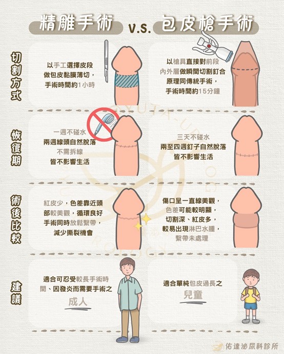 包皮槍手術優勢